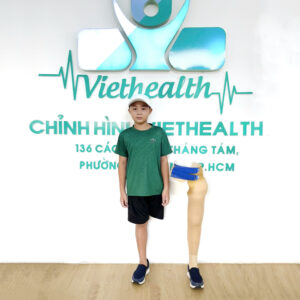 chân giả tháo khớp háng