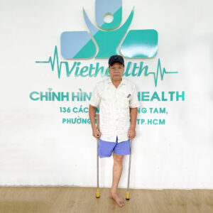 chân giả tháo khớp háng