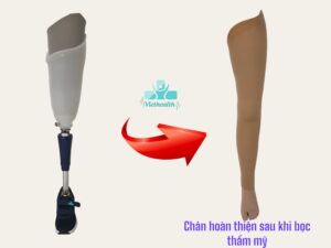 Hình ảnh minh họa mẫu chân giả trên gối số 2