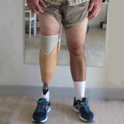 Lắp chân dưới gối