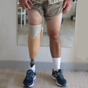 Lắp chân dưới gối