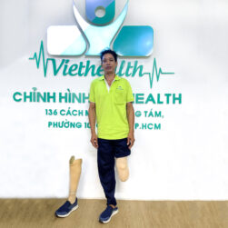 Chân giả dưới gối