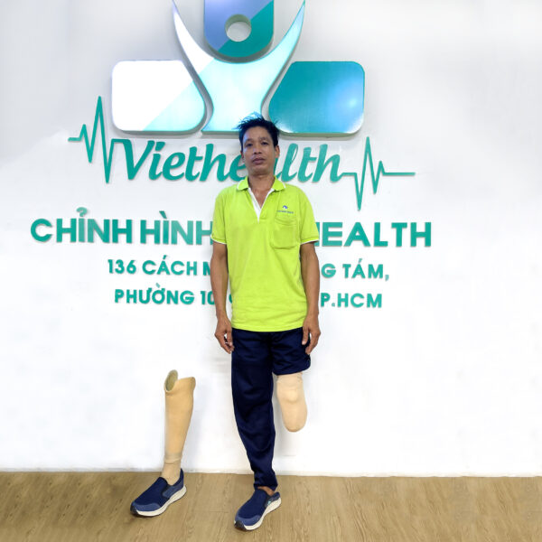 Chân giả dưới gối
