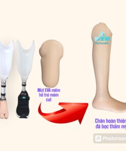 Alternative view of Chân giả dưới gối