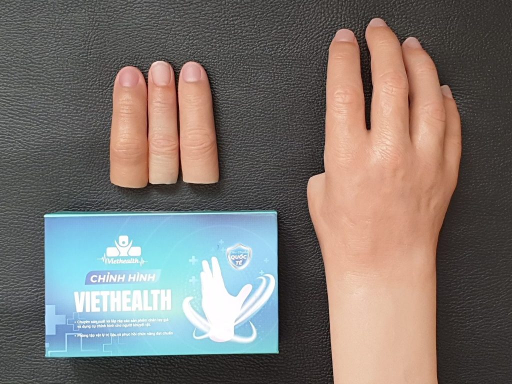 Bàn tay/ ngón tay silicon thẩm mỹ