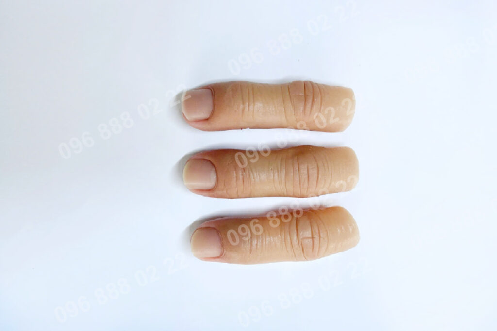 Ngón tay giả silicon thẩm mỹ