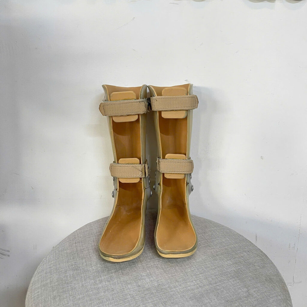 nẹp chỉnh hình tại viethealth