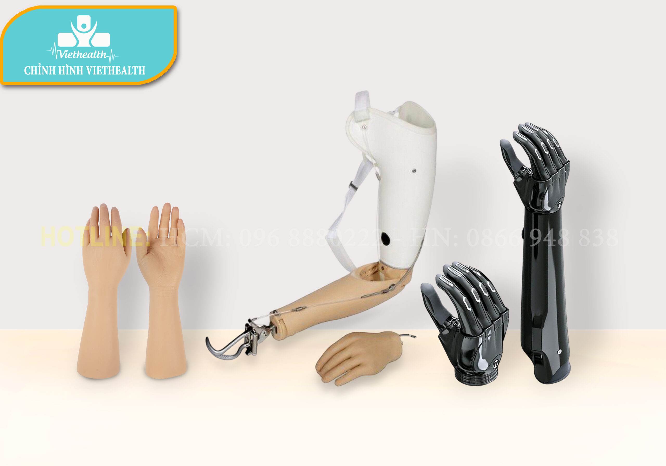 tay giả thẩm mỹ viethealth