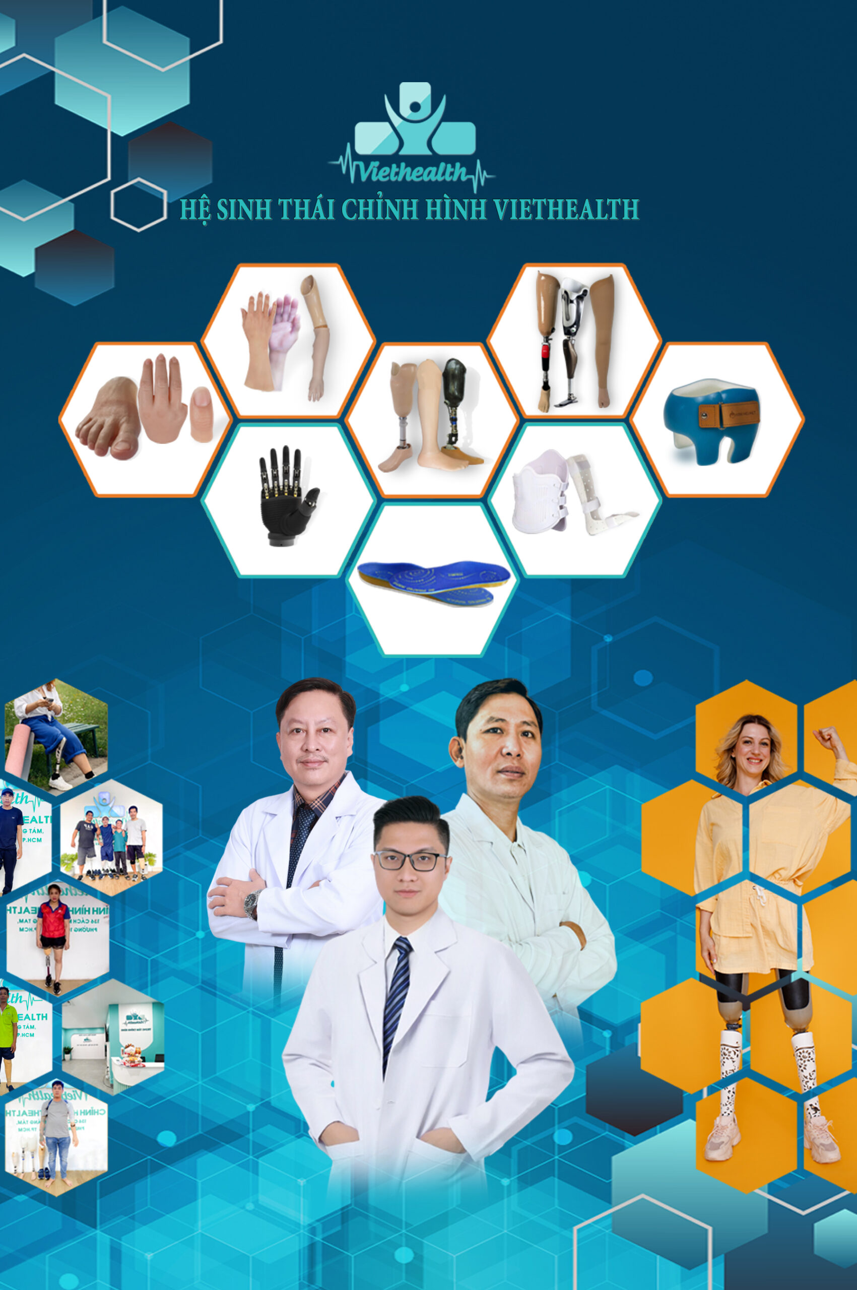 chân tay giả chỉnh hình viethealth