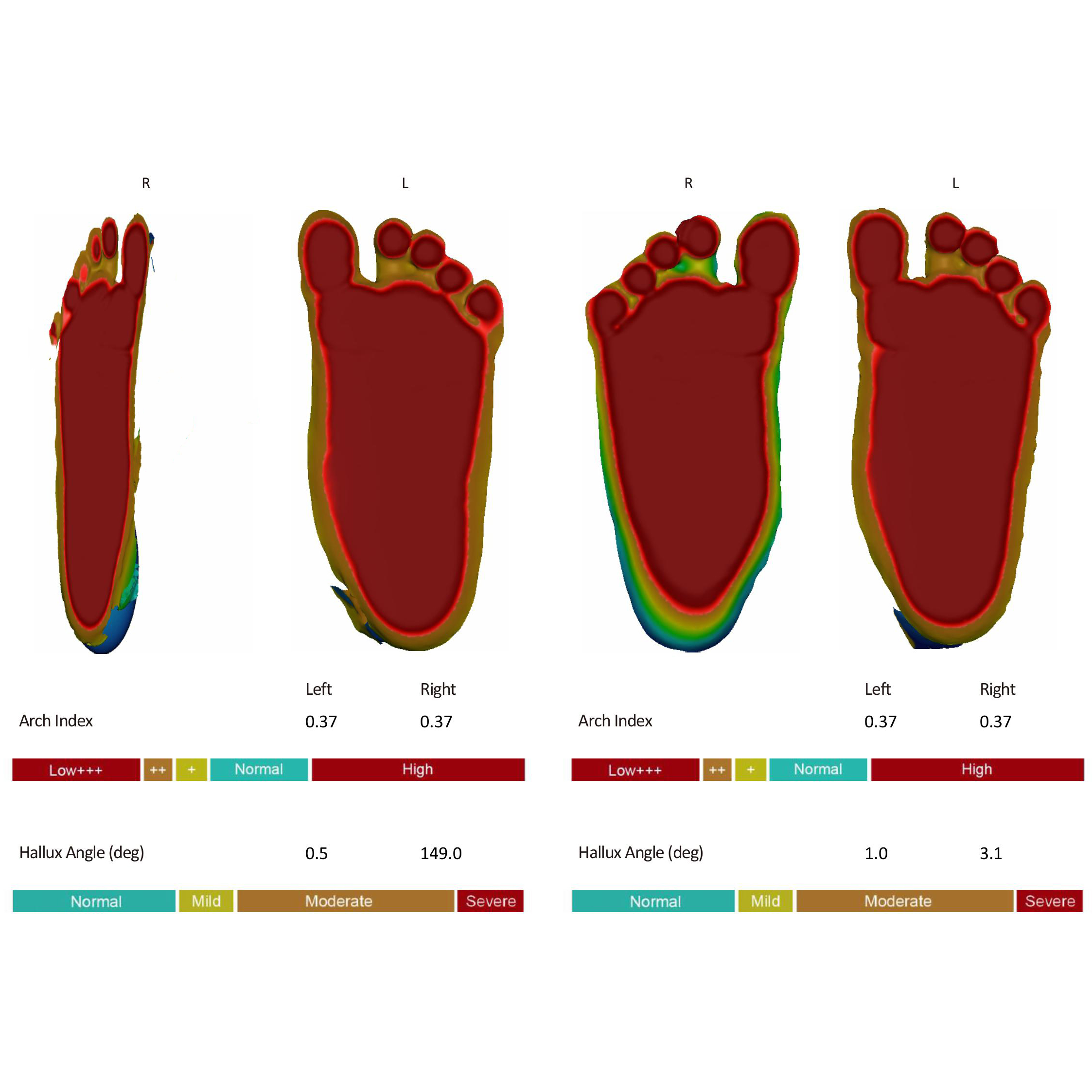 Hồ Vũ quốc khang_04112025_021110_000009_Compare
