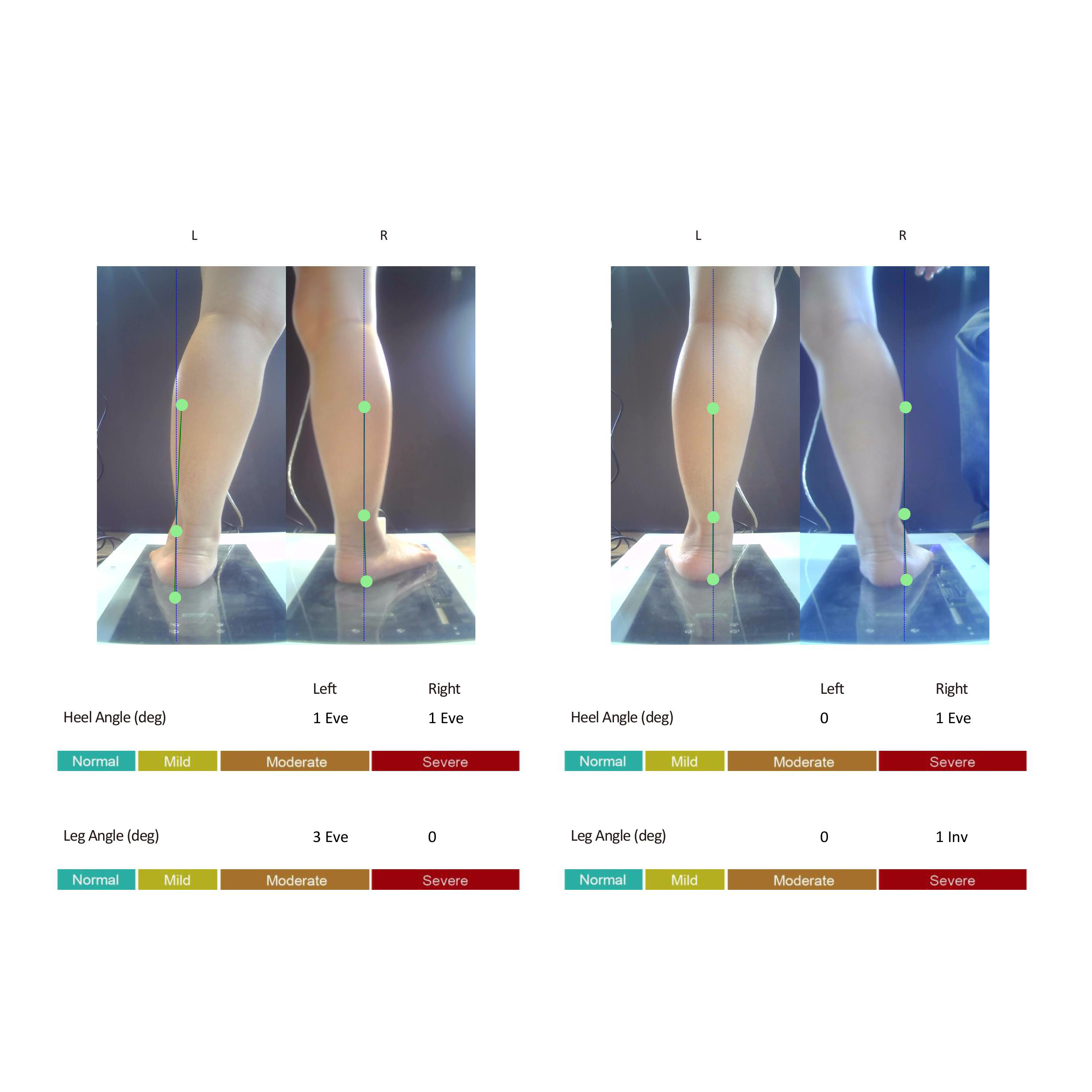 Hồ Vũ quốc khang__Compare