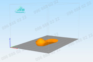 In 3D lót bàn chân bẹt - chỉnh hình viethealth