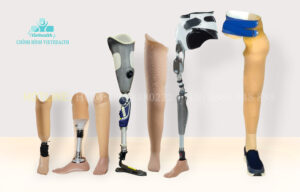 các loại chân giả tại viethealth