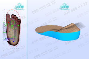 thiết kế lót bàn chân bẹt