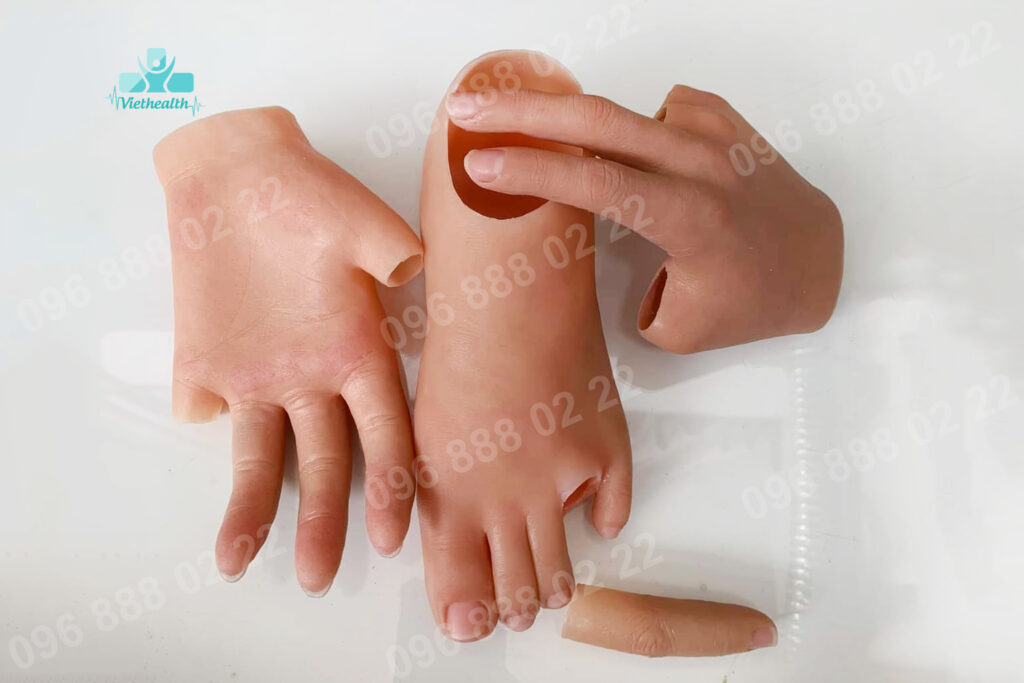 Làm Ngón Tay, Ngón Chân, Bàn Tay, Bàn Chân Silicon Thẫm Mỹ và Cánh Tay. Ở Đâu Uy Tín - Viethealth
