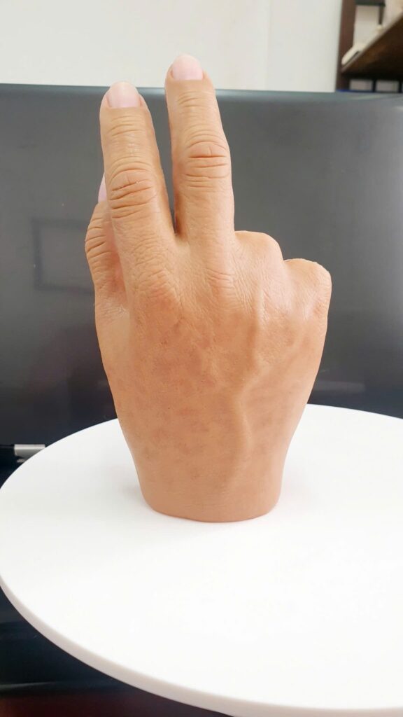 Ngón tay giả silicon- trường hợp mắt 1 ngón và 3 ngón