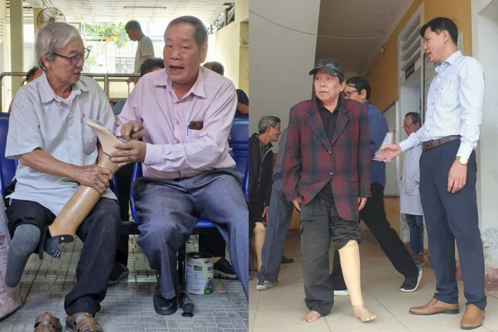 Bàn giao chân tay giả viethealth tại Huế