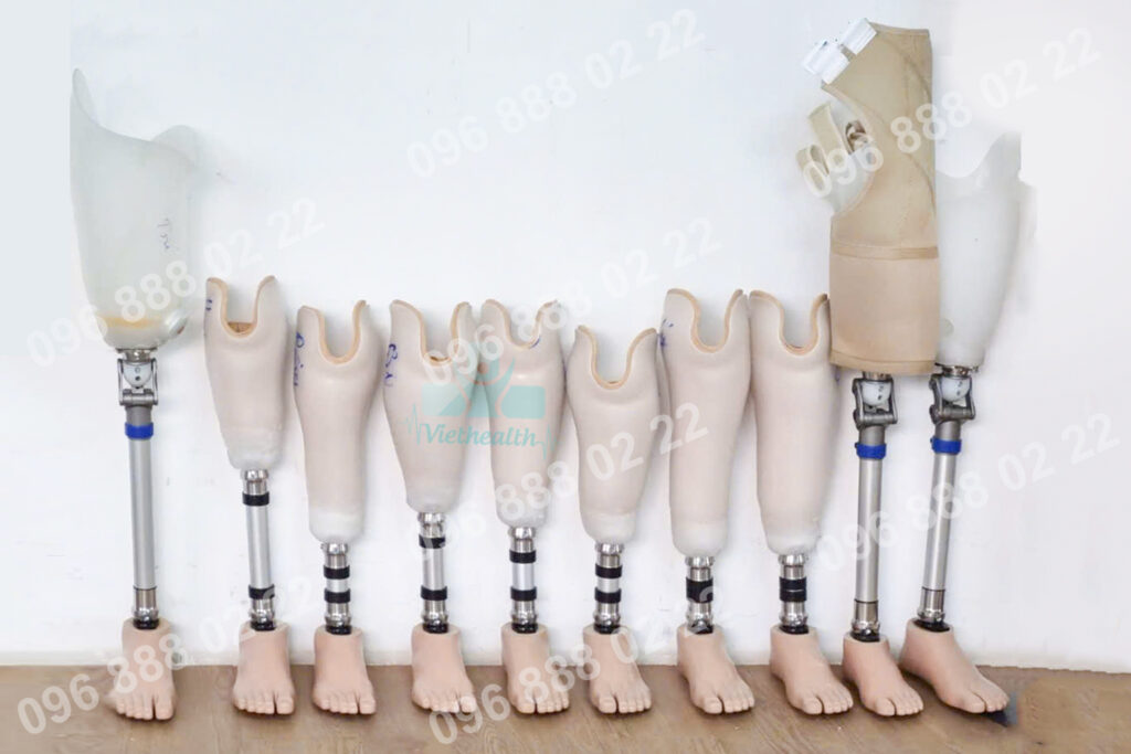 Chân tay giả viethealth - chỉnh hình viethealth