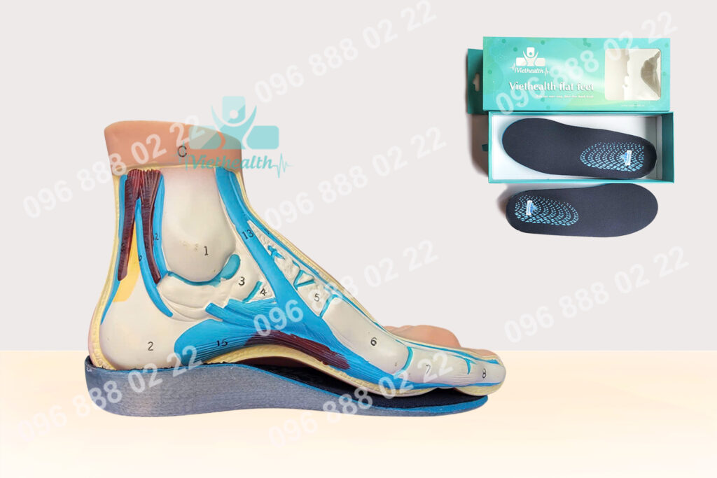 Dấu Hiệu Bàn Chân Bẹt Ở Trẻ Em – Nhận Biết Sớm Để Điều Trị Hiệu Quả Tại Chỉnh Hình Viethealth