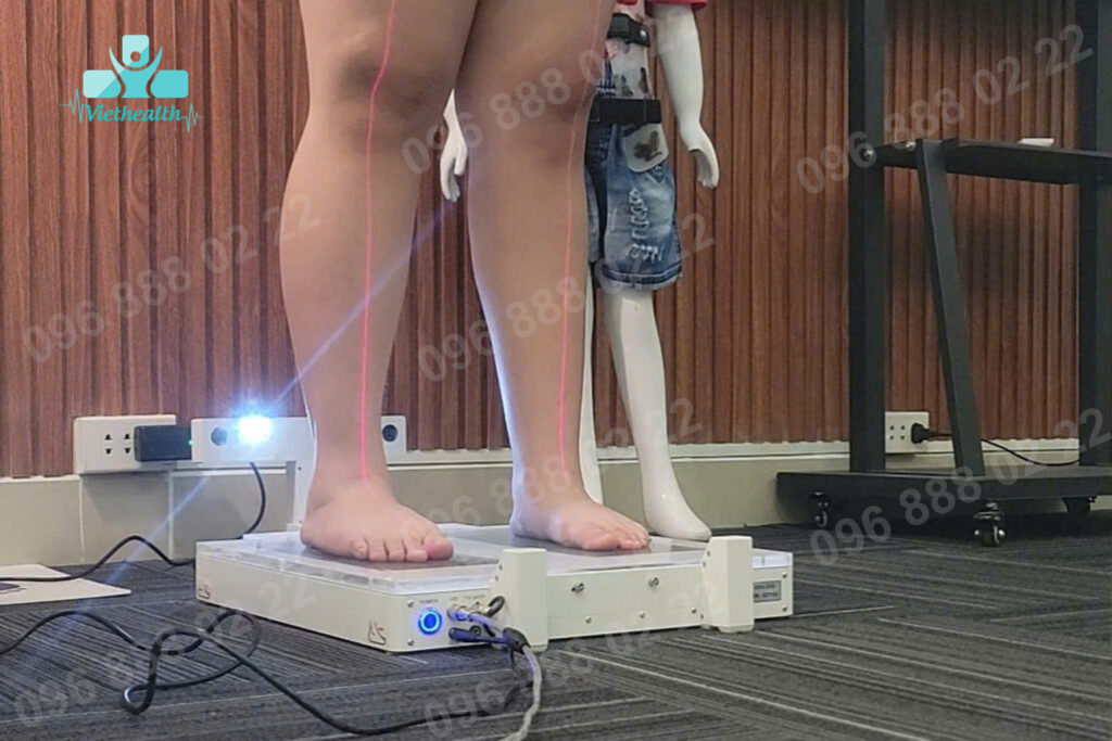 Máy quét bàn chân bẹt-1