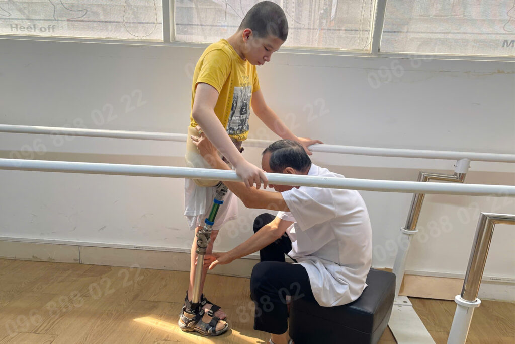 phục hồi chức năng sau cắt cụt chân