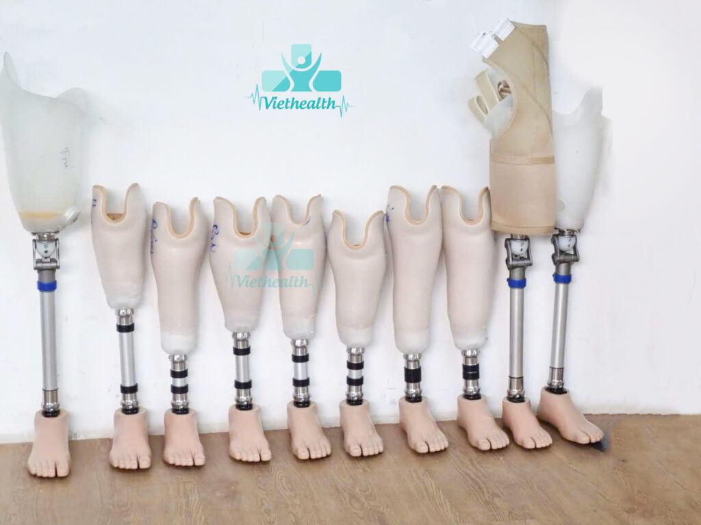 chân giả dưới gối và trên gối hiện đại