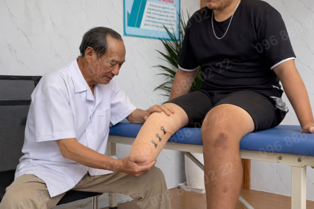 Chăm sóc mỏn cụt sau phẫu thuật cắt chân