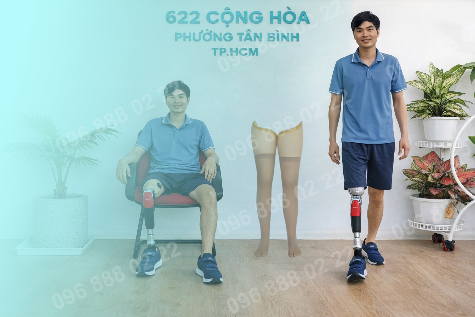 Chân Giả Trên Gối thẩm mỹ Giải Pháp Tối Ưu Cho Cuộc Sống Trọn Vẹn