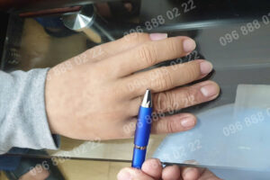 ngón tay giả silicon - chỉnh hình Viethealth