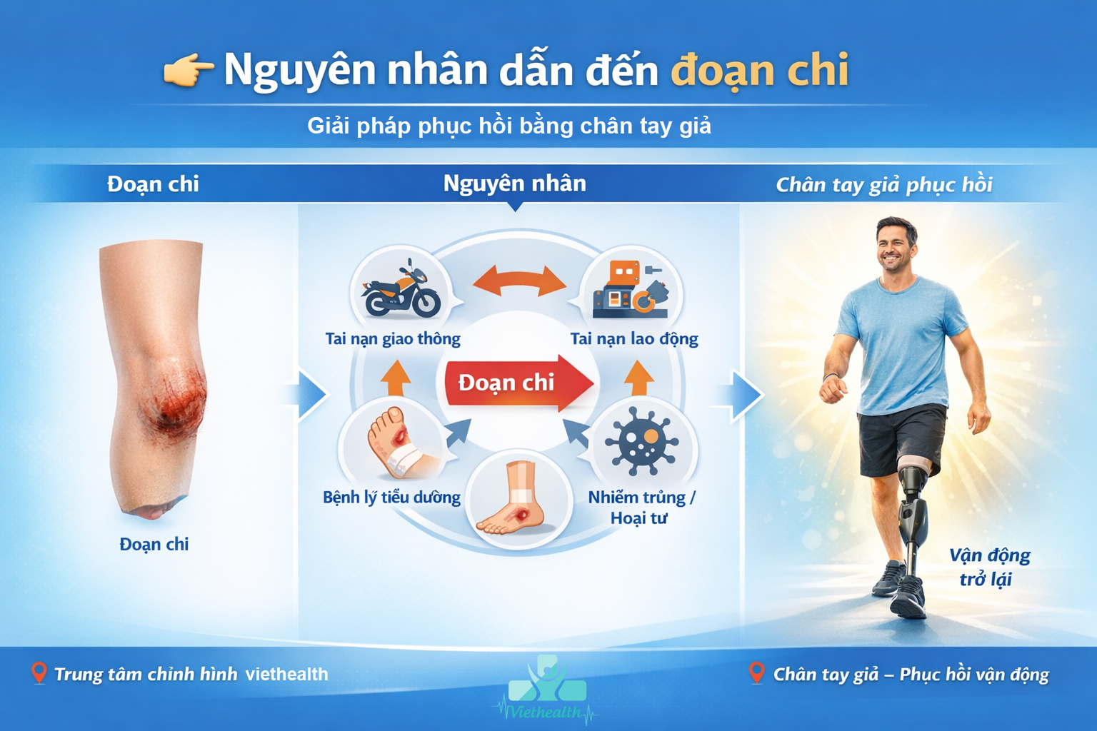 nguyên nhân liên quan tới đoạn chi phải lắp chân tay giả vẫn có thể bảo vệ sức khỏe