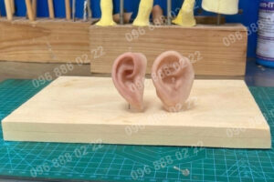 tai giả thẩm mỹ - chỉnh hình Viethealth