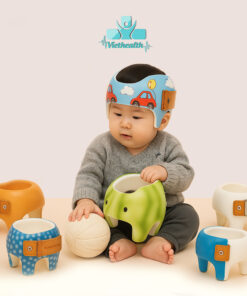 Mũ Chỉnh Hình 3D Viethealth – Giải Pháp Hiện Đại Cho Trẻ Bị Đầu Bẹt, Đầu Méo