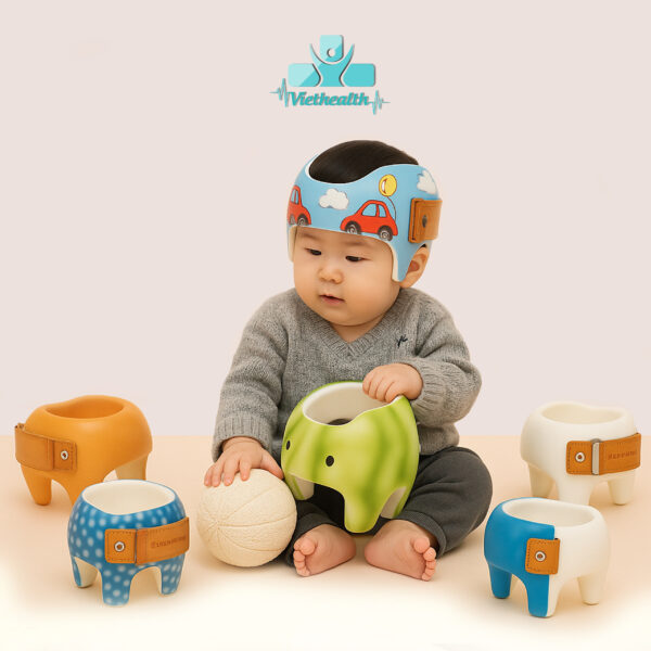 Mũ Chỉnh Hình 3D Viethealth – Giải Pháp Hiện Đại Cho Trẻ Bị Đầu Bẹt, Đầu Méo