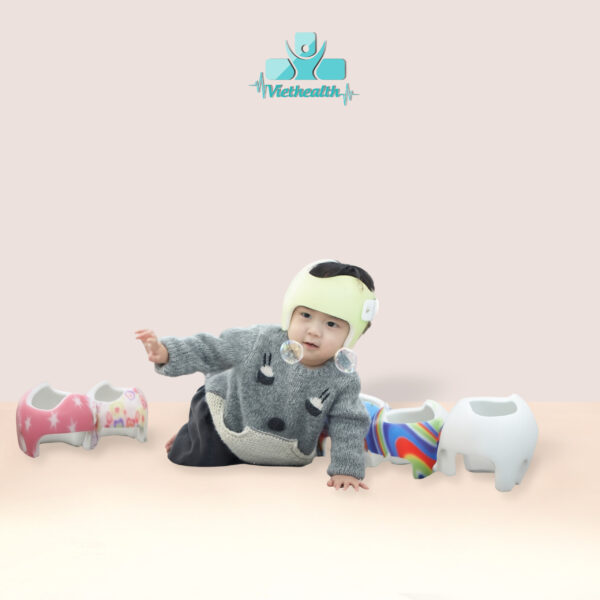 Alternative view of Mũ Chỉnh Hình 3D Viethealth – Giải Pháp Hiện Đại Cho Trẻ Bị Đầu Bẹt, Đầu Méo