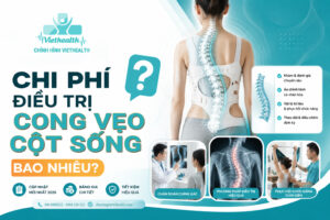 chi phí điều trị cong vẹo cột sống là bao nhiêu