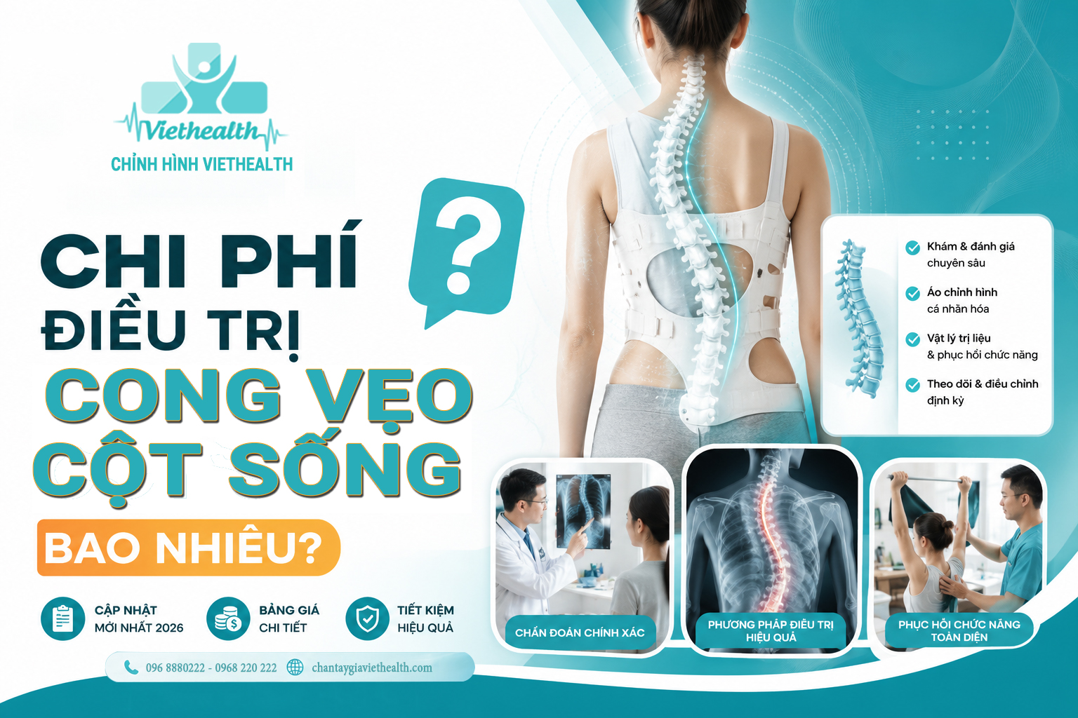 chi phí điều trị cong vẹo cột sống là bao nhiêu
