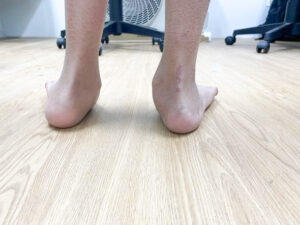 Lót giày chỉnh hình bàn chân bẹt Viethealth