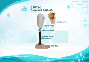 cấu tạo chân giả dưới gối.