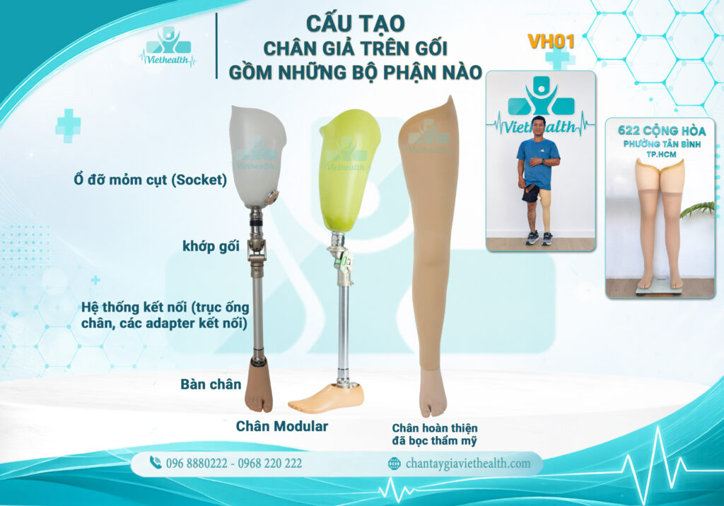 cấu tạo chân giả trên gối - viethealth