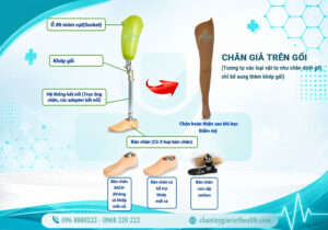 cau-tao-chan-gia-tren-goi-viethealth