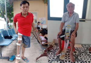 Nẹp chân trên gối - nẹp kafo - nẹp chỉnh hình